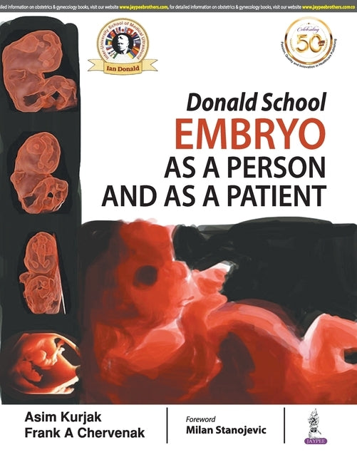 Embryo as a Person and as a Patient by Kurjak, Asim