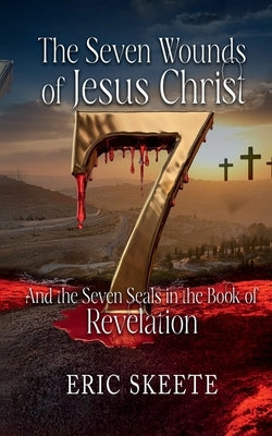 The Seven Wounds of Jesus Christ: And the Seven Seals in the book of Revelation by Skeete, Eric