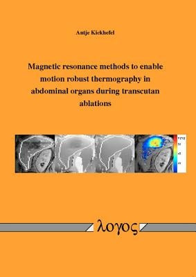 Magnetic Resonance Methods to Enable Motion Robust Thermography in Abdominal Organs During Transcutan Ablations by Kickhefel, Antje