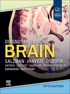 Diagnostic Imaging: Brain by Salzman, Karen L.