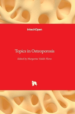 Topics in Osteoporosis by Valdés-Flores, Margarita