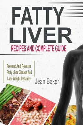 Fatty Liver: Recipes and Complete Guide to Prevent and Reverse Fatty Liver Disease and Lose Weight Instantly by Baker, Jean