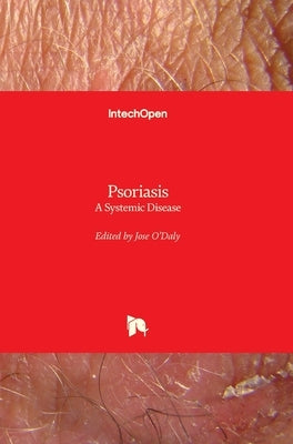 Psoriasis: A Systemic Disease by O' Daly, Jose