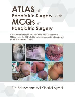 Atlas of Paediatric Surgery with Mcqs in Paediatric Surgery by Syed, Muhammad Khalid