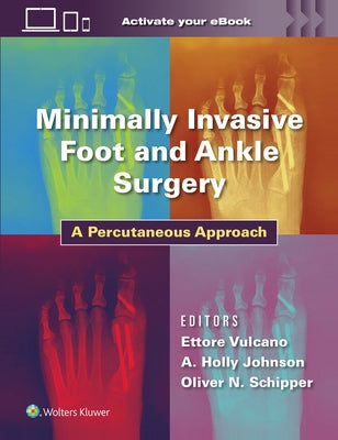 Minimally Invasive Foot and Ankle Surgery: A Percutaneous Approach by Vulcano, Ettore