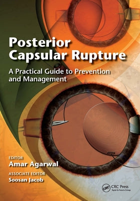 Posterior Capsular Rupture: A Practical Guide to Prevention and Management by Agarwal, Amar
