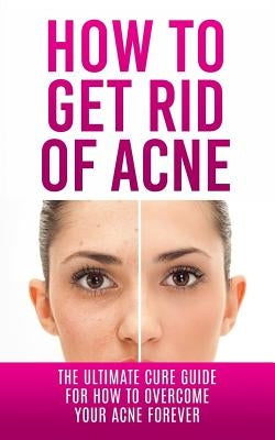How to Get Rid of Acne: The Ultimate Cure Guide for How to Overcome Your Acne Forever by Lincoln, Caesar