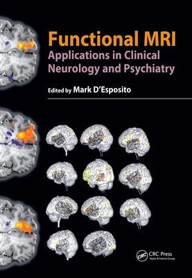 Functional MRI: Applications in Clinical Neurology and Psychiatry by D'Esposito, Mark