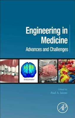 Engineering in Medicine: Advances and Challenges by Iaizzo, Paul A.