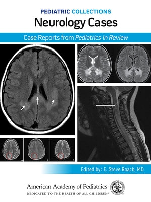 Pediatric Collections: Neurology Cases: Case Reports from Pediatrics in Review by American Academy of Pediatrics (Aap)