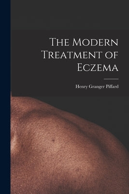 The Modern Treatment of Eczema by Piffard, Henry Granger