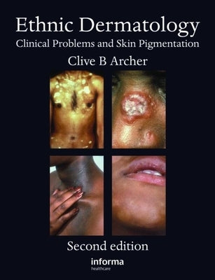 Ethnic Dermatology: Clinical Problems and Skin Pigmentation by Archer, Clive B.