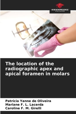 The location of the radiographic apex and apical foramen in molars by de Oliveira, Patrícia Yanne