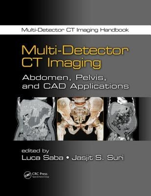Multi-Detector CT Imaging: Abdomen, Pelvis, and CAD Applications by Saba, Luca