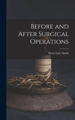 Before and After Surgical Operations by Smith, Dean Tyler