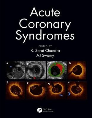 Acute Coronary Syndromes by Chandra, K. Sarat