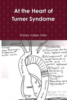 At The Heart of Turner Syndrome by Vallee Hiter, Shirley