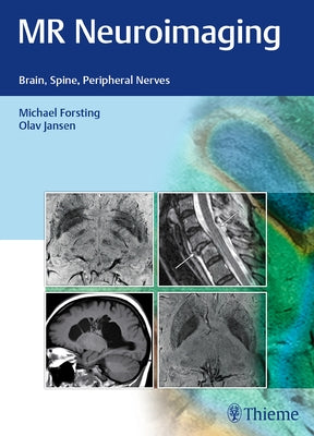MR Neuroimaging: Brain, Spine, Peripheral Nerves by Forsting, Michael