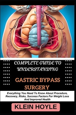 Complete Guide to Understanding Gastric Bypass Surgery: Everything You Need To Know About Procedure, Recovery, Risks, Success Factors For Weight Loss by Hoyle, Klein