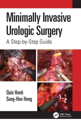 Minimally Invasive Urologic Surgery: A Step-by-Step Guide by Hooti, Qais
