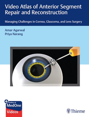 Video Atlas of Anterior Segment Repair and Reconstruction: Managing Challenges in Cornea, Glaucoma, and Lens Surgery by Agarwal, Amar