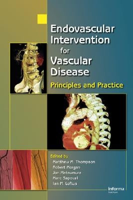 Endovascular Intervention for Vascular Disease: Principles and Practice by Thompson, Matt M.