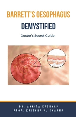 Barretts Oesophagus Demystified: Doctor's Secret Guide by Kashyap, Ankita