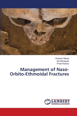 Management of Naso-Orbito-Ethmoidal Fractures by Menat, Shailesh
