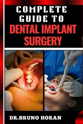 Complete Guide to Dental Implant Surgery: Comprehensive Manual To Advanced Techniques, Recovery, and Best Practices for Optimal Oral Health by Horan, Bruno