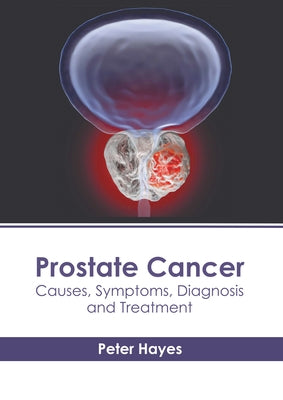 Prostate Cancer: Causes, Symptoms, Diagnosis and Treatment by Hayes, Peter