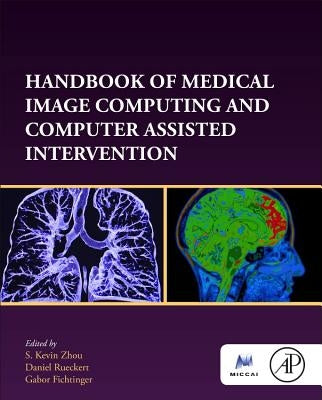 Handbook of Medical Image Computing and Computer Assisted Intervention by Zhou, S. Kevin