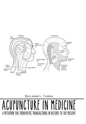 Acupuncture in Medicine: A Metaphor for Therapeutic Transactions in History to the Present by Thomas, Moolamanil