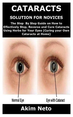 Cataracts Solution for Novices: The Step By Step Guide on How to Effectively Stop, Reverse and Cure Cataracts Using Herbs for Your Eyes (Curing your O by Neto, Akim