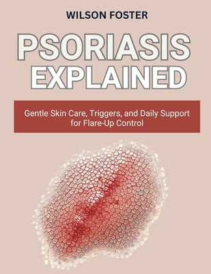 Psoriasis Explained: Gentle Skin Care, Triggers, and Daily Support for Flare-Up Control by Foster, Wilson