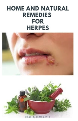 Home and Natural Remedies for Herpes: The Best Herbal And Natural Remedies To Get Rid Of All Form Of Herpes Virus by David, Dr Elizabeth