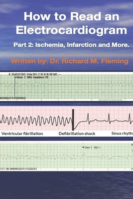 How to Read an Electrocardiogram: Part 2: Ischemia, Infarction and More. by Fleming, Richard M.