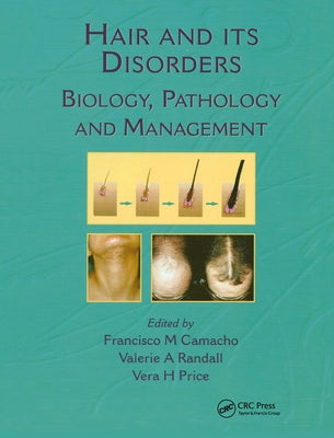 Hair and Its Disorders: Biology, Pathology and Management by Camacho, Francisco M.