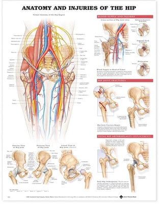 Anatomy and Injuries of the Hip Anatomical Chart by Anatomical Chart Company