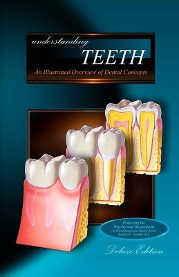 Understanding Teeth - Deluxe Edition: An Illustrated Overview of Dental Concepts by Gordon B. a., Stephen F.