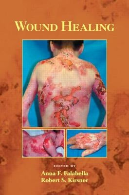 Wound Healing by Falabella, Anna