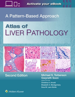 Atlas of Liver Pathology: A Pattern-Based Approach by Torbenson, Michael Scott