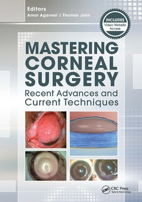 Mastering Corneal Surgery: Recent Advances and Current Techniques by Agarwal, Amar