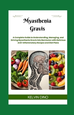 Myasthenia Gravis: A Complete Guide to Understanding, Managing, and Driving Myasthenia Gravis into Remission with Delicious Anti-Inflamma by Dino, Kelvin