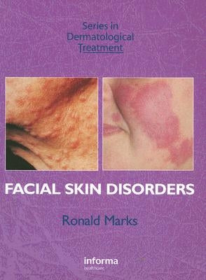 Facial Skin Disorders by Marks, Ronald
