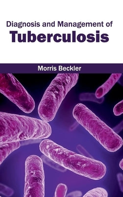 Diagnosis and Management of Tuberculosis by Beckler, Morris