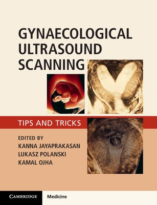 Gynaecological Ultrasound Scanning: Tips and Tricks by Jayaprakasan, Kanna