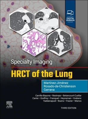 Specialty Imaging: Hrct of the Lung by Mart?nez-Jim?nez, Santiago