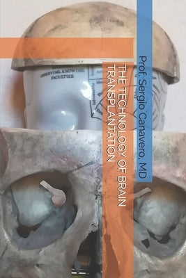 The Technology of Brain Transplantation by Canavero, Sergio
