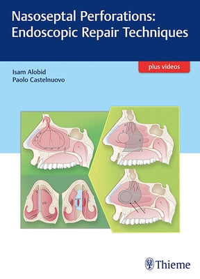 Nasoseptal Perforations: Endoscopic Repair Techniques by Alobid, Isam