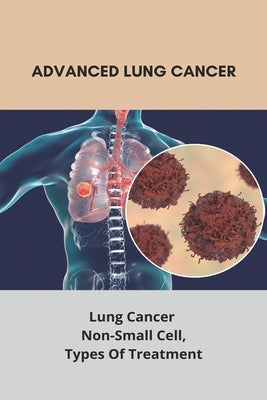 Advanced Lung Cancer: Lung Cancer - Non-Small Cell, Types Of Treatment: Lung Cancer Survival Rate by Wardian, Zachery
